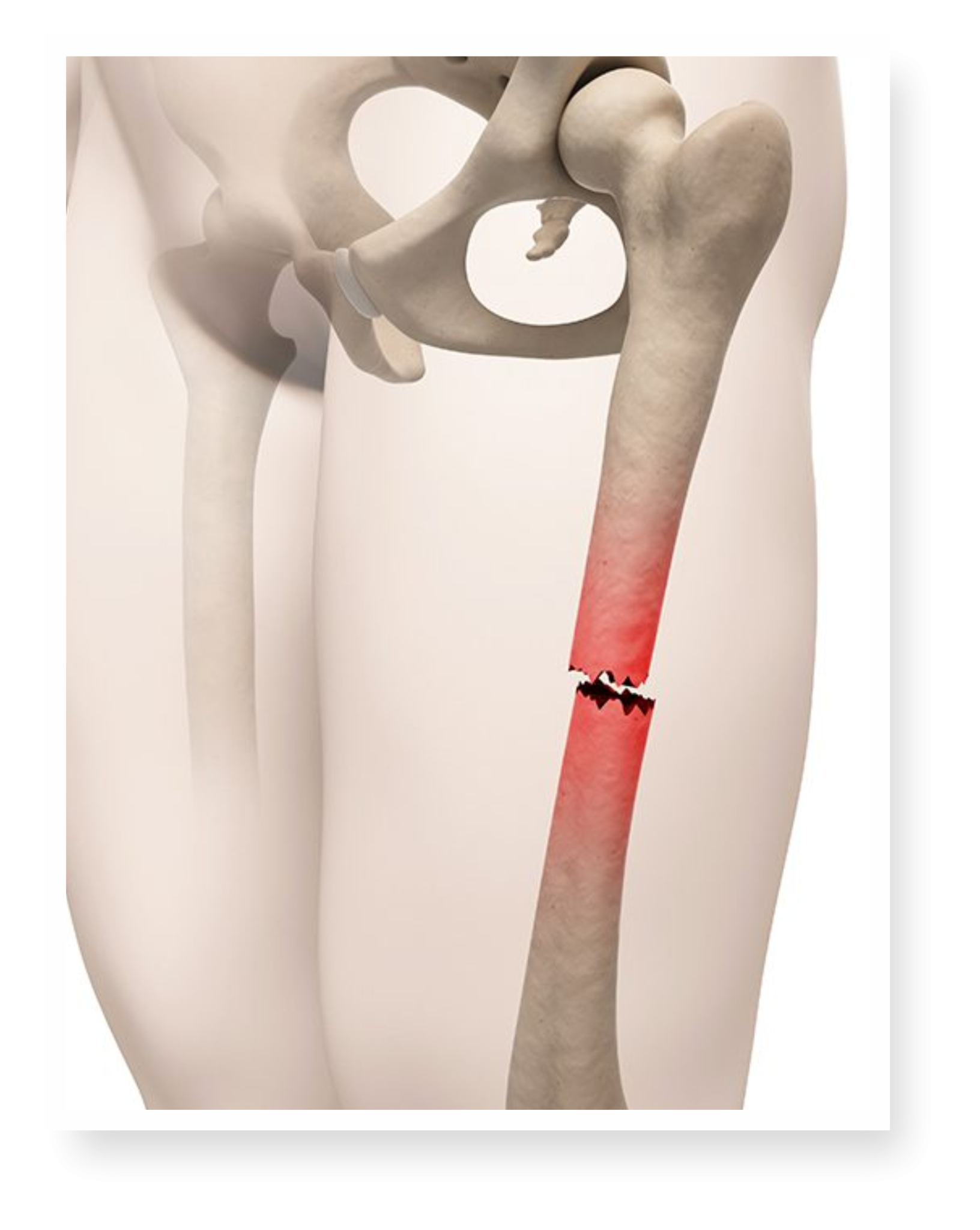 Complex Trauma – Dr. Rahul Puri